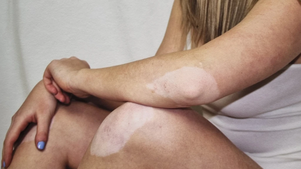 En Andra Blick – Emma Vald och Hannah Ståhlnacke